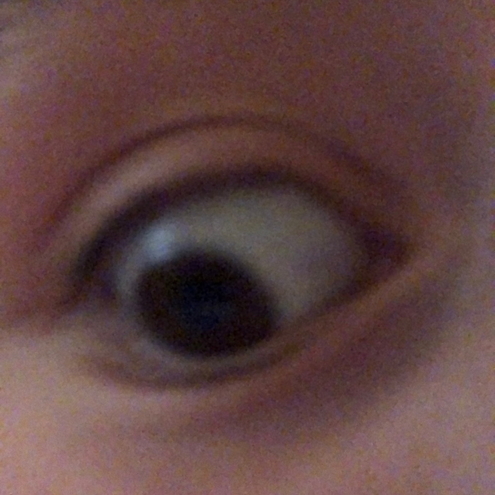 MY EYEBALL